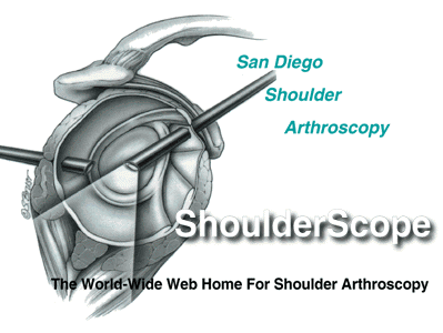San Diego Shoulder Arthroscopy.